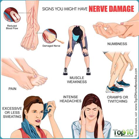 Nerve Damage Causes Symptoms And Complications Top 10 Home Remedies