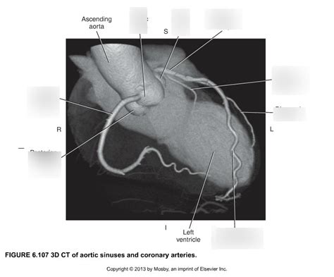 Coronary Arteries And Aortic Sinus Diagram Quizlet
