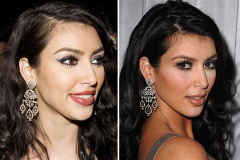 kim kardashian before and after