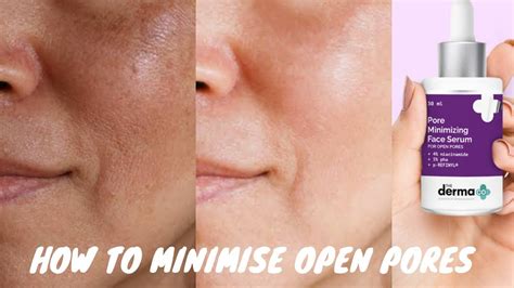 Skincare Routine To Minimise Open Large Pores Derma Co Pore Minimizing Niacinamide Serum