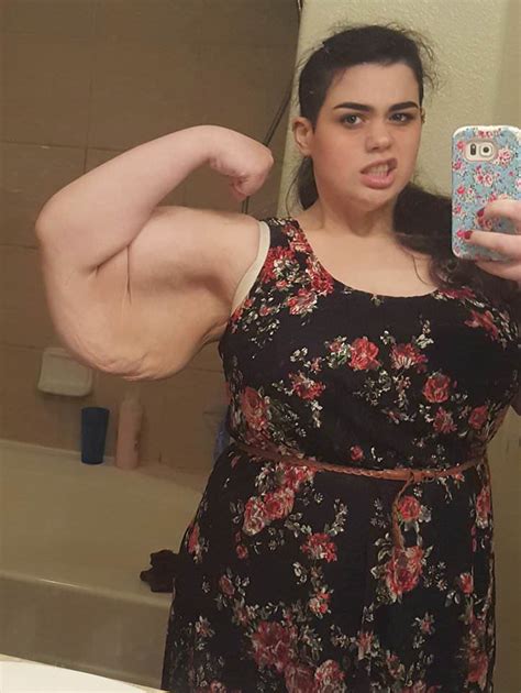 She Weighed 300 Kilos Now Look At Her Incredible Transformation After