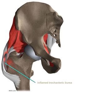 Within them, sharpey's fibers pass through the bone covering (periosteum) to embed in the bone. Hip - Physiomed