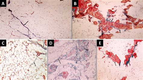 A Photomicrograph Of Inguinal Adipose Tissue Sections Showing A