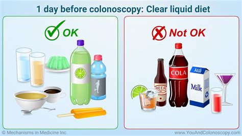 During a colonoscopy, a long, flexible tube (colonoscope) is inserted into the rectum. What is a colonoscopy and how do I prepare for it? | Clear ...