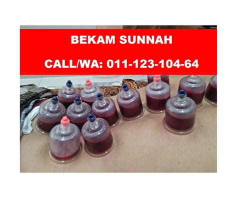 Dsadar make up & photographer. CALL/WA 011-123-10464 (Bekam Sunnah), Pusat Rawatan Bekam ...