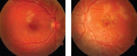 Es dient als medizinisches kurzlexikon. A Rare Syndrome in Your Chair