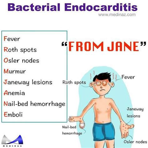 Bacterial Endocarditis Medizzy