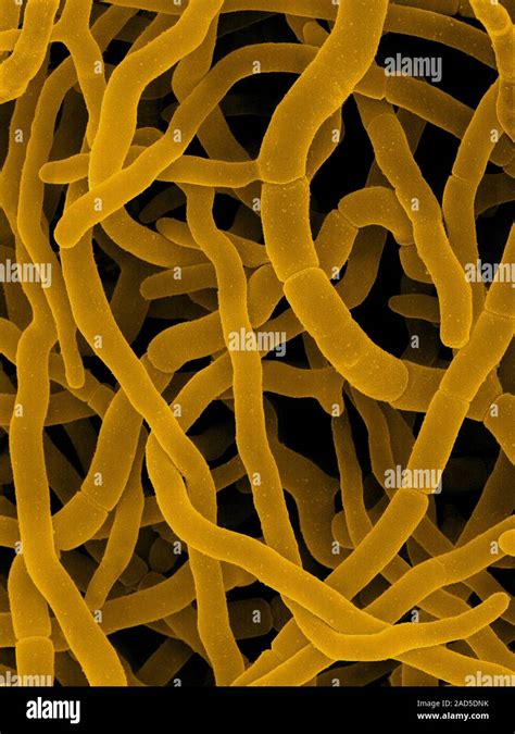 Coloured Scanning Electron Micrograph Sem Of Streptomyces Rimosus