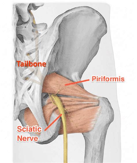 Piriformis Pain Map