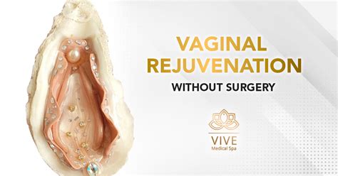Non Surgical Vaginal Rejuvenation Vive Medical Spa
