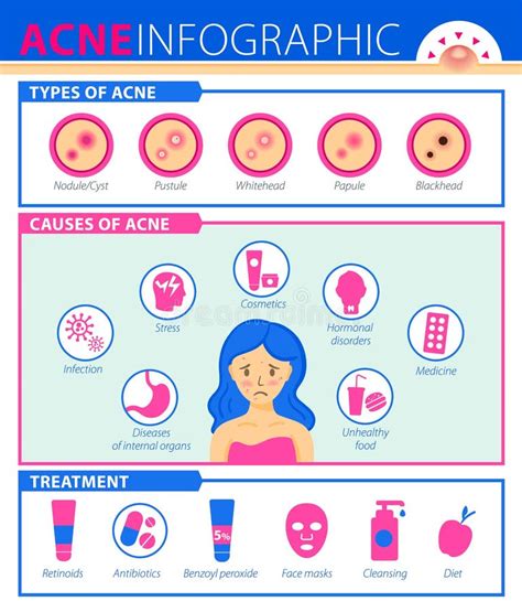 Types Of Acne Causes Of The Disease Treatment Infographics Of Acne