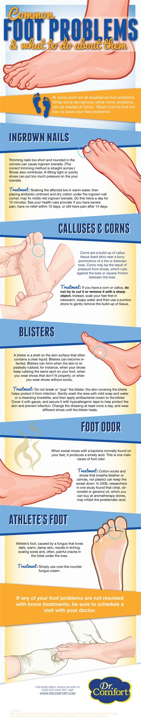 Common Foot Problems And What To Do About Them Infographic