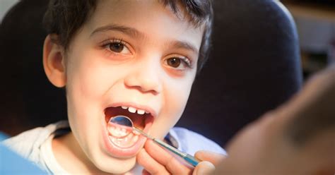 The Biting Truth About Dental Cavities In Children Pediatric Dentistry