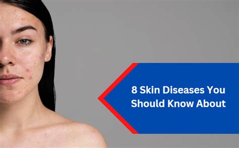 8 Skin Diseases You Should Know About Kalpit Healthcare