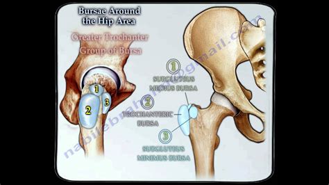 Bursitis Around The Hip Everything You Need To Know Dr Nabil Ebraheim Youtube