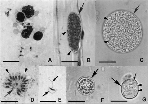 1 Stages Of Toxoplasma Gondii A Tachyzoites In Impression Smear Of