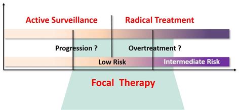 Fokale Therapien Vs Radikale Behandlungen Eine Evidenzbasierte
