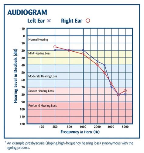 Audiology Diagnostic Assessment City Hearing Audiology Services