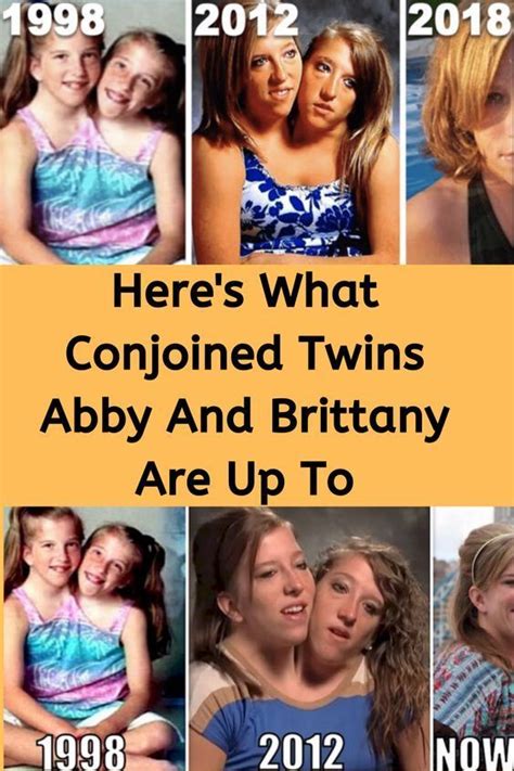 The twins also have their own hearts, gallbladders and stomachs. Here's What Conjoined Twins Abby And Brittany Are Up To in 2020 | Famous twins, Conjoined twins ...