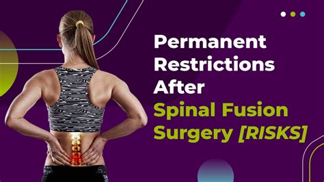 Permanent Restrictions After Spinal Fusion Surgery [risks] Youtube