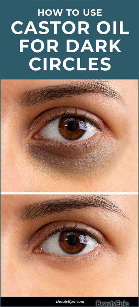 Can You Use Castor Oil Under Your Eyes Diseasedappynessclub