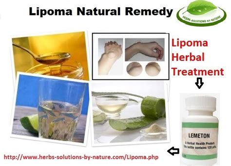 How To Get Rid Of Lipoma With Natural Remedy Ovarian Cyst Lipoma