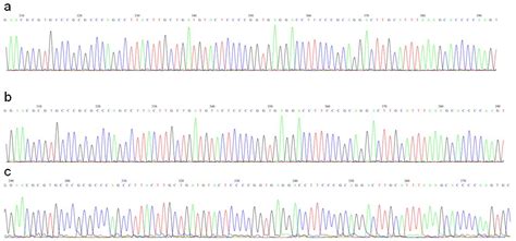 Guide To Sanger Sequencing By Capillary Electrophoresis From Education