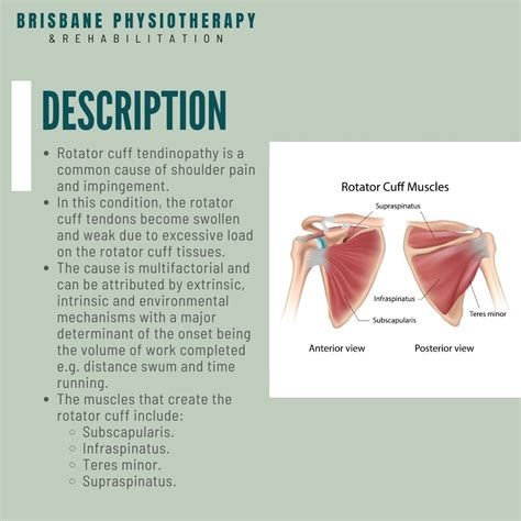 What Is A Rotator Cuff Tendinopathy Brisbane Physiotherapy