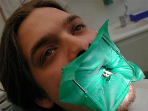 Rubber Dental Dams What They Are And Why Dentists Use Them Oral Answers