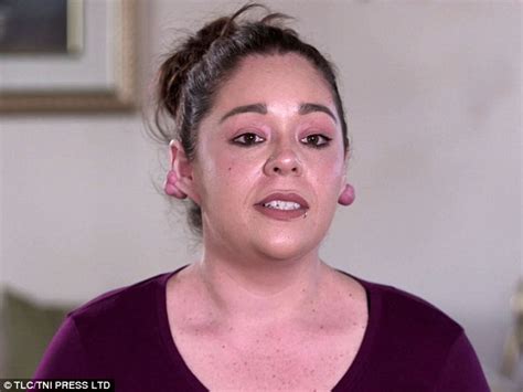 Woman 29 Has Dangling Lumps Sliced Off Her Ears By Dr Pimple Popper
