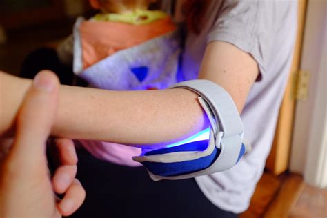 Bluecontrol By Philips For Plaque Psoriasis Review