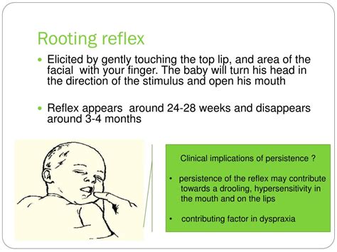 Ppt Primitive Reflexes In The Baby Powerpoint Presentation Free