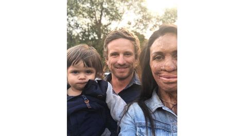 The Intimate Family Pictures Of Turia Pitt Before The Fire That Almost Took Her Life OverSixty