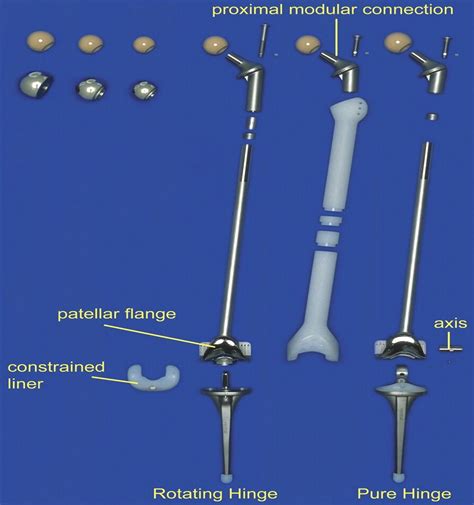 Revision Arthroplasty With Use Of A Total Femur Prosthesis Jbjs