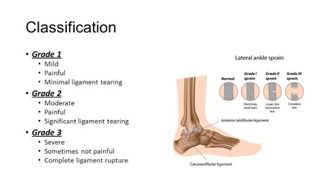 Grade 2 Ligament Sprain Sprained Ankle Orthoinfo Aaos The Ligament