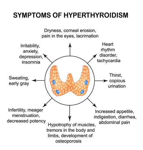 Hyperthyroidism Symptoms And Signs