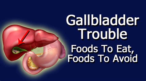 Gallbladder Trouble Foods To Eat Foods To Avoid Youtube
