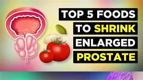 Top Foods To Shrink Enlarged Prostate Youtube