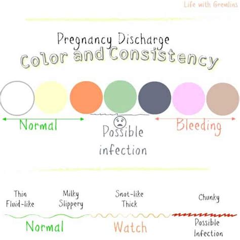 Milenium Home Tips Light Green Vaginal Discharge