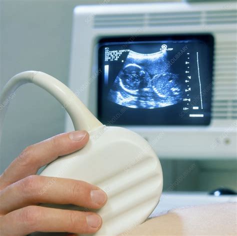 Ultrasound Scanning Of A Pregnant Woman Stock Image M