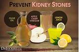 Home Remedies For Calcium Oxalate Kidney Stones Images
