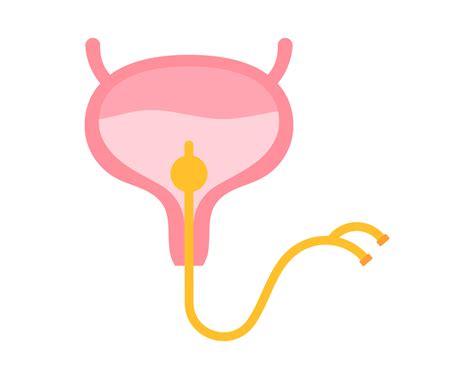 Sonda Direto Na Bexiga