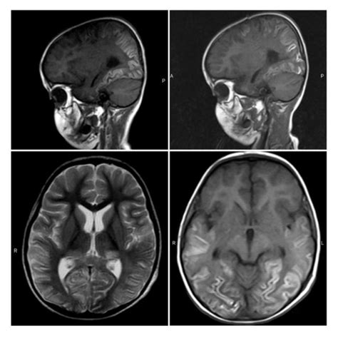 Mri Obtained From Brain Images Of Brain Mri Proposed Mostly