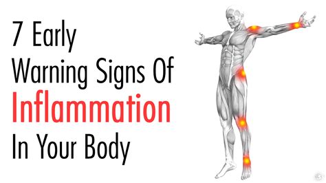Inflammation Pictures