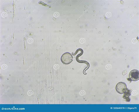 Toxocara Canis Second Stage Larvae Hatch From Eggs Stock Photo Image