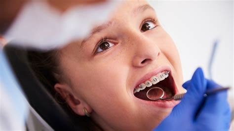 Kids Braces Straightening Smiles And Boosting Confidence