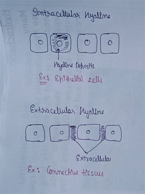 Difference In Intracellular And Extracellular Hyaline Change