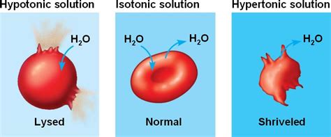 Hypertonic solution results in cell crenation or contraction. water_balance-animals.html 07_13WaterBalanceA.jpg