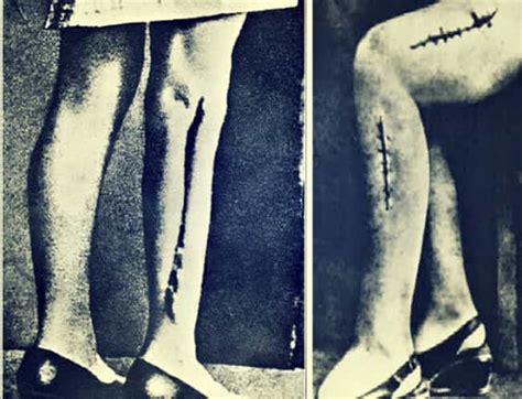 The Most Horrifying Nazi Experiments On Humans Cool Dump