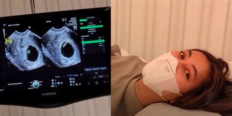 Hamil 6 Minggu – newstempo